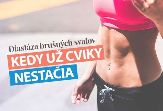 diastáza brušných svalov.jpg