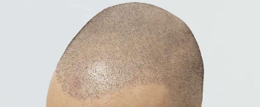 mikropigmentacia-vlasov.jpg