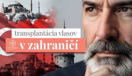 tranplantacia-vlasov-zahranicie.jpg