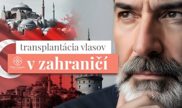 tranplantacia-vlasov-zahranicie.jpg