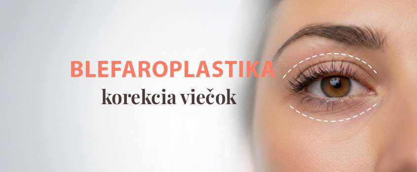 blefaroplastika-operacia-viecok.jpg