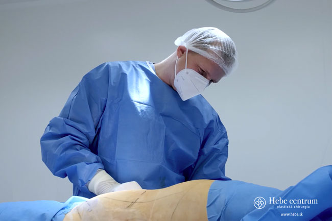 MUDr Peter Mertan počas výkonu operácie abdominoplastika