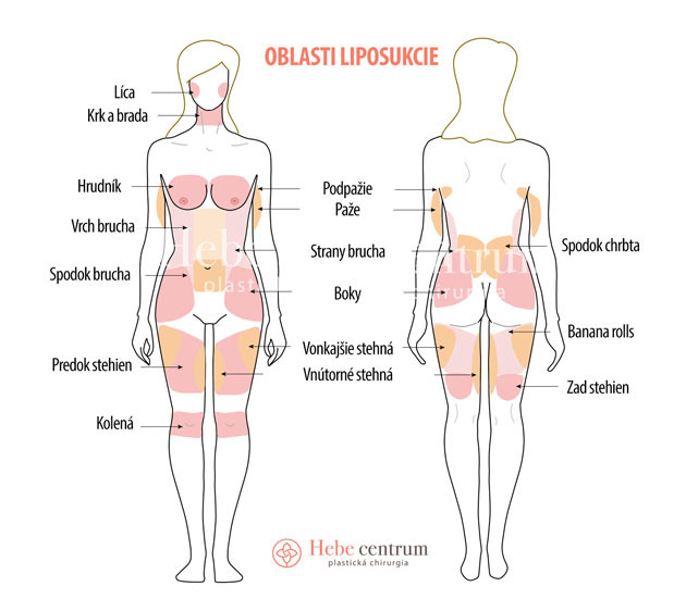 oblasti liposukcie